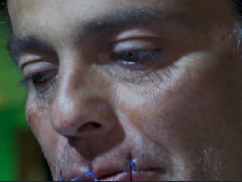 Jhon Fittzgerald se cose la boca, día uno.